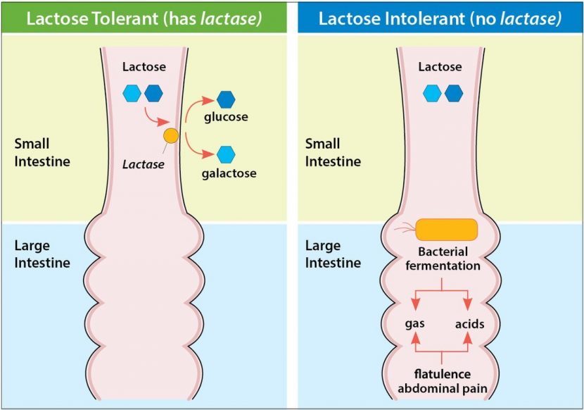 আপনার শিশুটি ল্যাকটোজ ইন্টলারেন্সে ভুগছে না তো?
