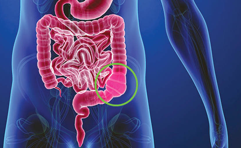 ইউরিন ইনফেকশন | প্রসাবে সমস্যার কারণ লক্ষণ ও চিকিৎসা কি?