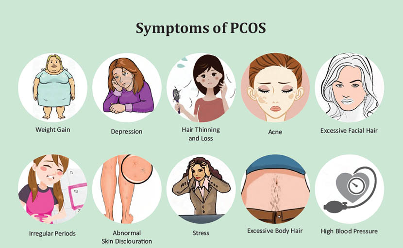 পলিসিস্টিক ওভারিয়ান সিনড্রোমের লক্ষণ, কারণ ও চিকিৎসা জানেন কী?