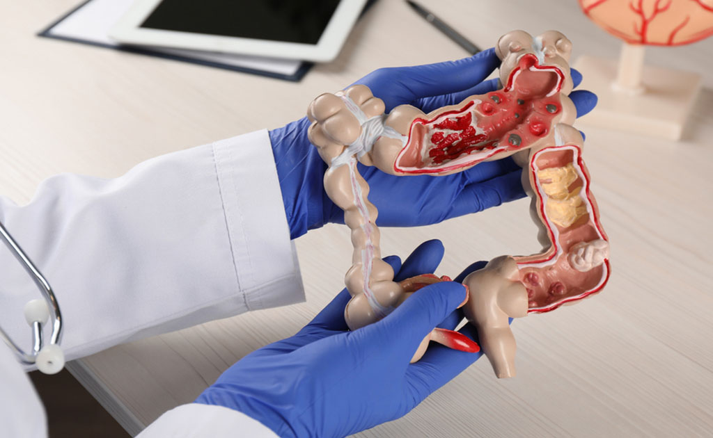 অতিরিক্ত রেড মিট খাওয়া আমাদের স্বাস্থ্যের জন্য কতটা ক্ষতিকর?